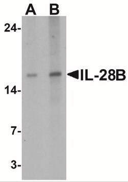 IL-28B/IFN-lambda 3 Antibody - BSA Free, Novus Biologicals 0.1mg; Unlabeled:Antibodies,