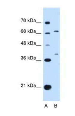 IL-28R alpha/IFN-lambda R1 Antibody, Novus Biologicals 0.05mg; Unlabeled:Antibodies,