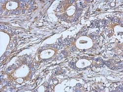 IL-2 Antibody, Novus Biologicals 0.1mL; Unlabeled:Antibodies, Polyclonal