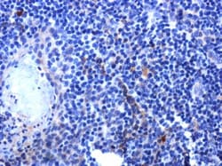 IL-2 Antibody, Novus Biologicals 0.1mL; Unlabeled:Antibodies, Polyclonal