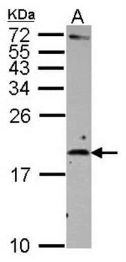 IL-2 Antibody, Novus Biologicals 0.1mL; Unlabeled:Antibodies, Polyclonal