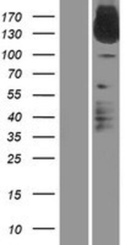 Novus Biologicals™ IL-31RA Overexpression Lysate