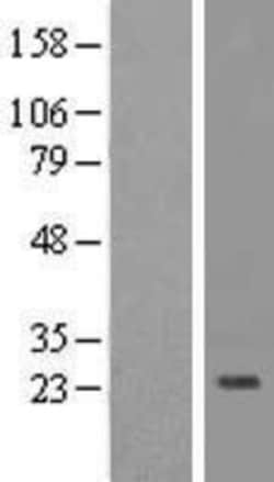 Novus Biologicals™ IL-32 Overexpression Lysate