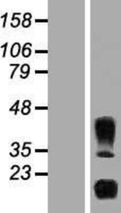 Novus Biologicals&trade;&nbsp;IL-32 Overexpression Lysate