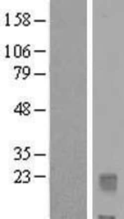Novus Biologicals&trade;&nbsp;IL-32 Overexpression Lysate
