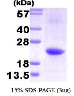 Novus Biologicals&trade;&nbsp;Recombinant Human IL-32 His Protein