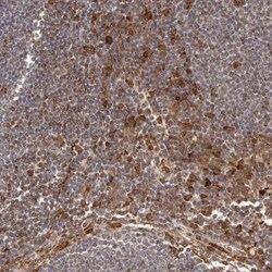 IL-32 Antibody, Novus Biologicals:Antibodies:Primary Antibodies