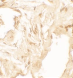 IL-36 beta/IL-1F8 Antibody - BSA Free, Novus Biologicals:Antibodies:Primary