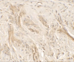 IL-36 gamma/IL-1F9 Antibody - BSA Free, Novus Biologicals:Antibodies:Primary