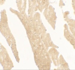 IL-36Ra/IL-1F5 Antibody - BSA Free, Novus Biologicals 0.1mg; Unlabeled:Antibodies,