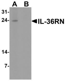 IL-36Ra/IL-1F5 Antibody - BSA Free, Novus Biologicals 0.1mg; Unlabeled:Antibodies,