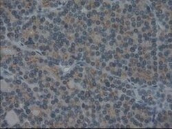 IL-3 Antibody (OTI3B11), Novus Biologicals 0.1mL; Unlabeled:Antibodies,