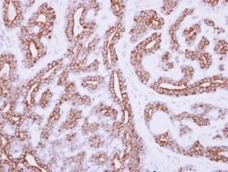 IL-3R alpha/CD123 Antibody, Novus Biologicals 0.1mL; Unlabeled:Antibodies,