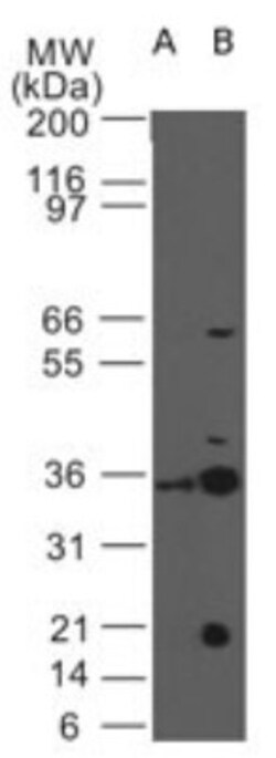 IL-3R alpha/CD123 Antibody (18N6B12), Novus Biologicals:Antibodies:Primary