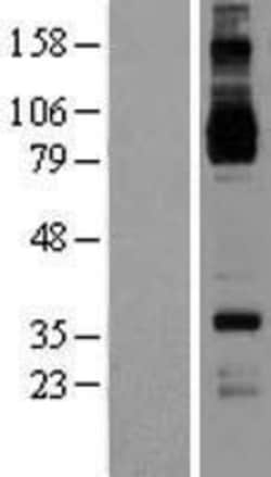 Novus Biologicals&trade;&nbsp;IL-4R alpha Overexpression Lysate