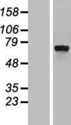 Novus Biologicals&trade;&nbsp;IL-4I1 Overexpression Lysate