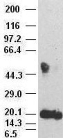 IL-6 Antibody (OTI3G9), Novus Biologicals 0.1mL; Unlabeled:Antibodies,