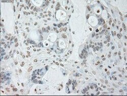 IL-6 Antibody (OTI3G9), Novus Biologicals 0.1mL; Unlabeled:Antibodies,