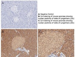 IL-6 Antibody, Novus Biologicals 0.1mg; Unlabeled:Antibodies, Polyclonal