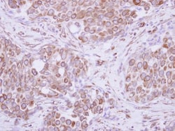 IL-6 Antibody, Novus Biologicals 0.1mL; Unlabeled:Antibodies, Polyclonal