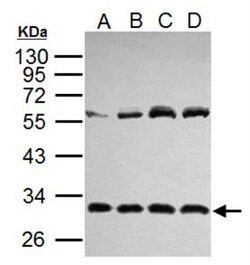 IL-6 Antibody, Novus Biologicals 0.1mL; Unlabeled:Antibodies, Polyclonal