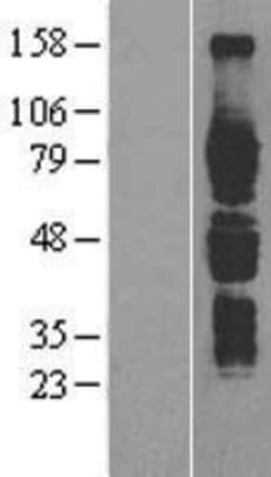 Novus Biologicals™ IL6R Overexpression Lysate
