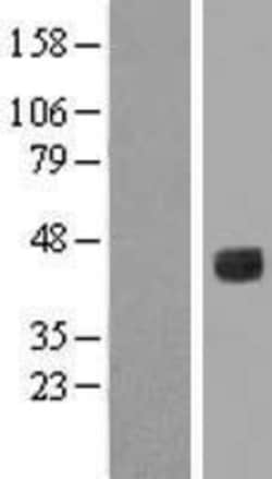 Novus Biologicals&trade;&nbsp;IL6R Overexpression Lysate