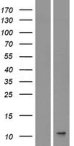 Novus Biologicals™ CXCL8/IL-8 Overexpression Lysate