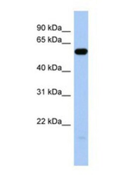 ILDR1 Antibody, Novus Biologicals 0.05mg; Unlabeled:Antibodies, Polyclonal