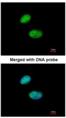ILF1 Antibody, Novus Biologicals 0.1mL; Unlabeled:Antibodies, Polyclonal