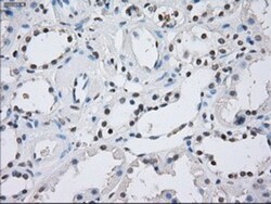 ILF2 Antibody (OTI6F1), Novus Biologicals 0.1mL; Unlabeled:Antibodies,