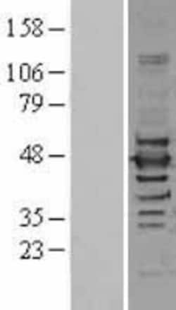 Novus Biologicals™ ILF2 Overexpression Lysate