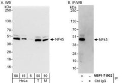 ILF2 Antibody, Novus Biologicals 0.1mg; Unlabeled:Antibodies, Polyclonal