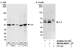 ILK Antibody, Novus Biologicals 0.1mL; Unlabeled:Antibodies, Polyclonal