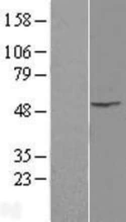 Novus Biologicals&trade;&nbsp;ILK Overexpression Lysate