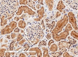 ILK Antibody, Novus Biologicals 0.1mg; Unlabeled:Antibodies, Polyclonal