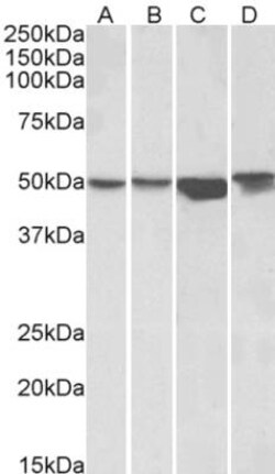 ILK Antibody, Novus Biologicals 0.1mg; Unlabeled:Antibodies, Polyclonal