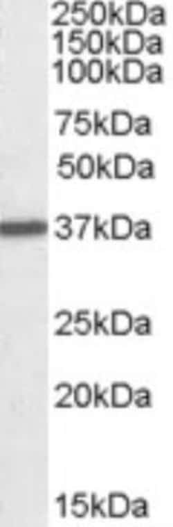 ILK Antibody, Novus Biologicals 0.1mg; Unlabeled:Antibodies, Polyclonal