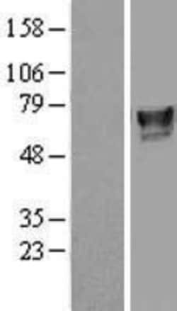 Novus Biologicals™ ILVBL Overexpression Lysate