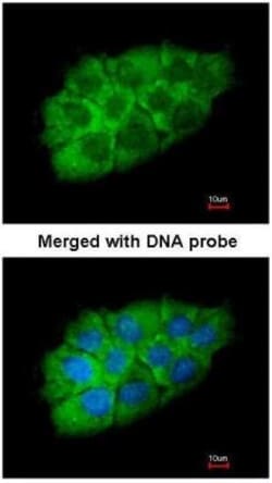 IMP2/IGF2BP2 Antibody, Novus Biologicals 0.1mg; Unlabeled:Antibodies, Polyclonal