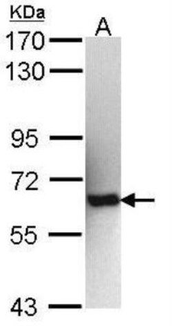 IMP2/IGF2BP2 Antibody, Novus Biologicals 0.1mg; Unlabeled:Antibodies, Polyclonal
