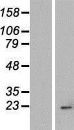 Novus Biologicals™ IMP3 Overexpression Lysate