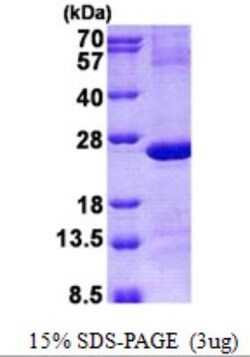 Novus Biologicals Recombinant Human IMP3 His Protein 0,1 mg | Buy Online | Novus Biologicals&trade; | Fisher Scientific