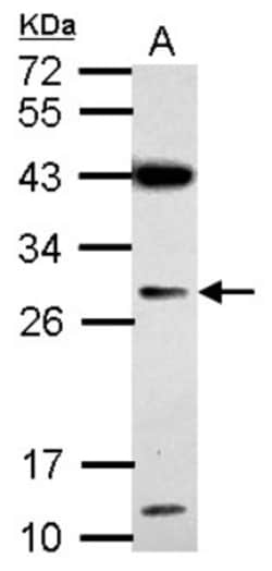 IMP4 Antibody, Novus Biologicals 0.1mL; Unlabeled:Antibodies, Polyclonal