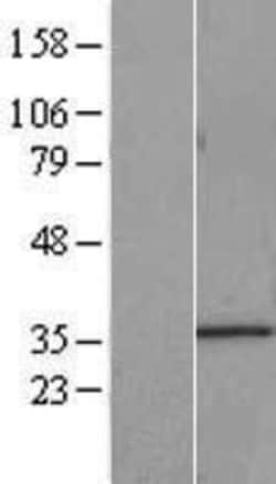 Novus Biologicals&trade;&nbsp;IMP4 Overexpression Lysate