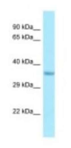 IMP4 Antibody, Novus Biologicals 100 &mu;L | Buy Online | Novus Biologicals | Fisher Scientific