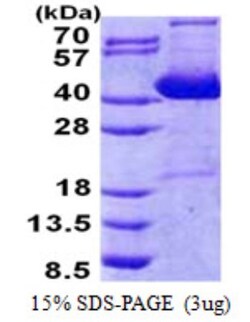 Novus Biologicals&trade;&nbsp;Recombinant Human IMPACT His Protein