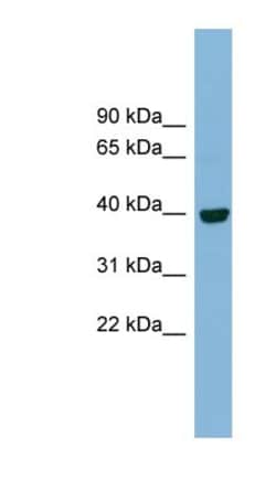 Inositol Monophosphatase 3/IMPAD1 Antibody, Novus Biologicals 100&mu;L;