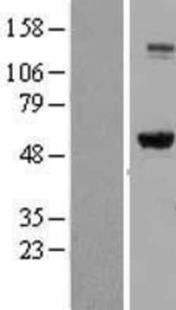 Novus Biologicals™ IMP Dehydrogenase 2/IMPDH2 Overexpression Lysate