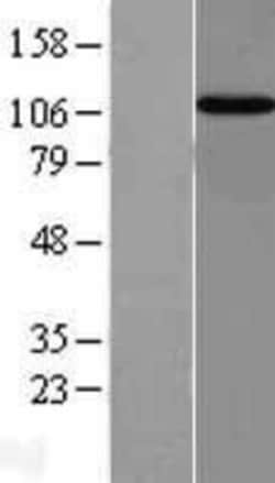 Novus Biologicals&trade;&nbsp;Importin-13 Overexpression Lysate